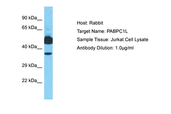 PABPC1L Rabbit Polyclonal Antibody