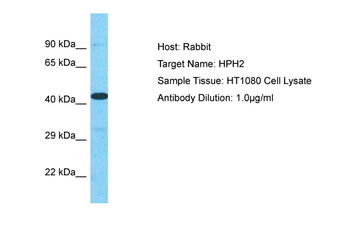 PHC1 Rabbit Polyclonal Antibody