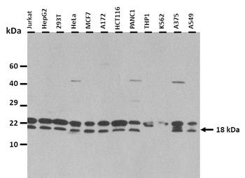 RPL24 Rabbit Polyclonal Antibody