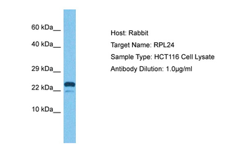 RPL24 Rabbit Polyclonal Antibody