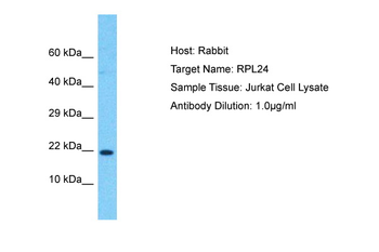 RPL24 Rabbit Polyclonal Antibody