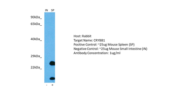 CRYBB1 Rabbit Polyclonal Antibody
