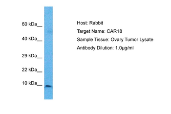 CARD18 Rabbit Polyclonal Antibody
