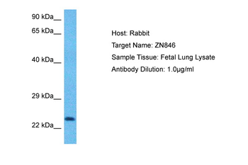 ZNF846 Rabbit Polyclonal Antibody