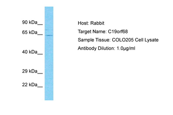 ZSWIM9 Rabbit Polyclonal Antibody