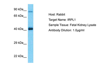 IL1RAPL1 Rabbit Polyclonal Antibody