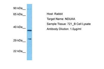 NDUFA10 Rabbit Polyclonal Antibody
