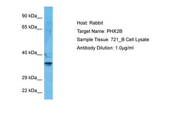 PHOX2B Rabbit Polyclonal Antibody