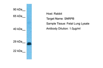 SNRPB Rabbit Polyclonal Antibody