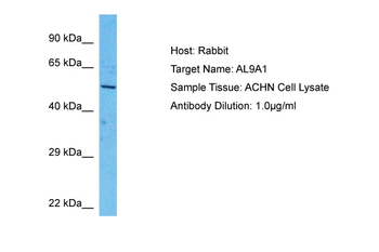 ALDH9A1 Rabbit Polyclonal Antibody