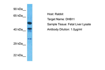 HSD17B11 Rabbit Polyclonal Antibody