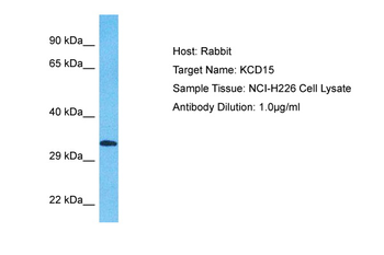KCTD15 Rabbit Polyclonal Antibody