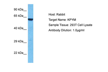 PKM Rabbit Polyclonal Antibody