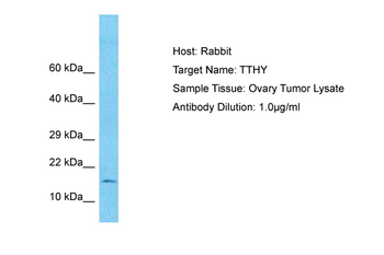 TTR Rabbit Polyclonal Antibody