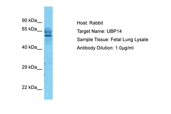 USP14 Rabbit Polyclonal Antibody