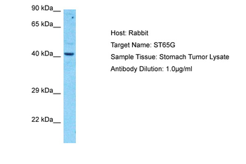 SUPT7L Rabbit Polyclonal Antibody