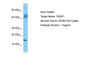 CARHSP1 Rabbit Polyclonal Antibody