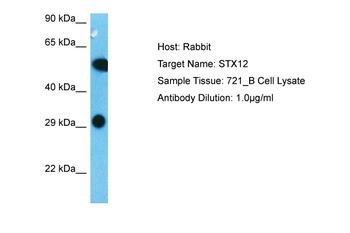STX12 Rabbit Polyclonal Antibody