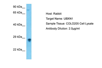 UBXN1 Rabbit Polyclonal Antibody