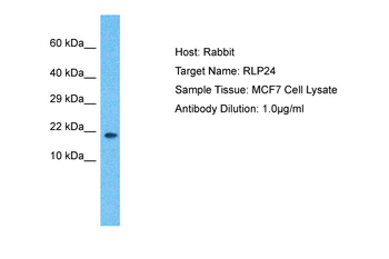 RSL24D1 Rabbit Polyclonal Antibody