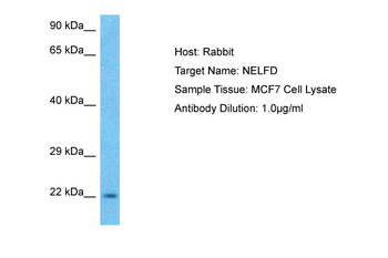 NELFCD Rabbit Polyclonal Antibody