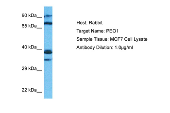 TWNK Rabbit Polyclonal Antibody