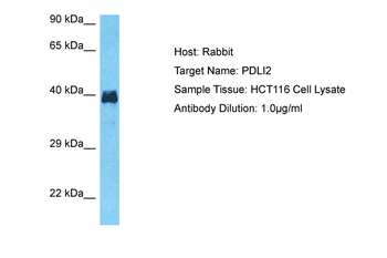PDLIM2 Rabbit Polyclonal Antibody