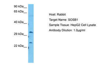 NABP2 Rabbit Polyclonal Antibody