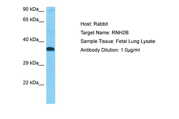 RNASEH2B Rabbit Polyclonal Antibody