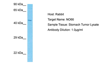 RIOX1 Rabbit Polyclonal Antibody