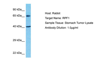 RPF1 Rabbit Polyclonal Antibody