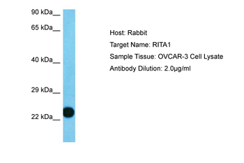 RITA1 Rabbit Polyclonal Antibody