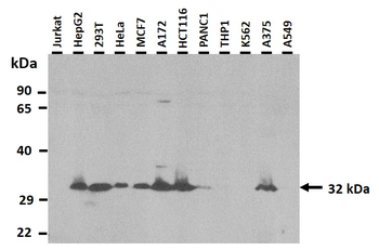 SLC25A6 Rabbit Polyclonal Antibody