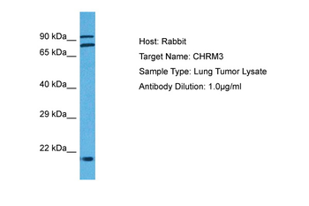 CHRM3 Rabbit Polyclonal Antibody