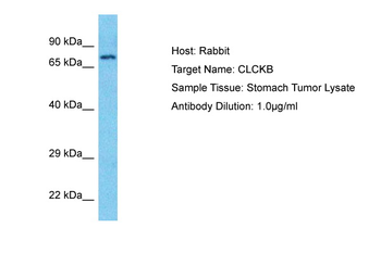 CLCNKB Rabbit Polyclonal Antibody