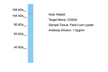 COL5A2 Rabbit Polyclonal Antibody