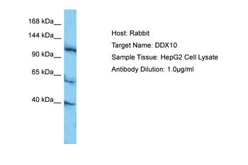 DDX10 Rabbit Polyclonal Antibody