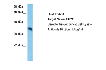 EPYC Rabbit Polyclonal Antibody