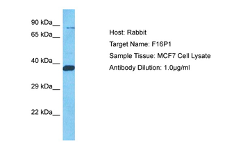 FBP1 Rabbit Polyclonal Antibody