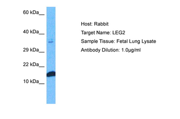 LGALS2 Rabbit Polyclonal Antibody