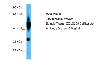 MAGEA4 Rabbit Polyclonal Antibody