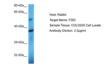 PFKFB2 Rabbit Polyclonal Antibody