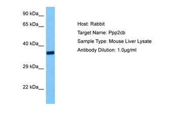 PPP2CA Rabbit Polyclonal Antibody