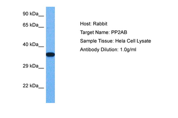 PPP2CA Rabbit Polyclonal Antibody