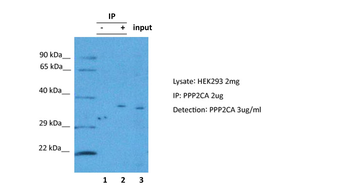 PPP2CA Rabbit Polyclonal Antibody