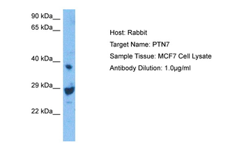 PTPN7 Rabbit Polyclonal Antibody