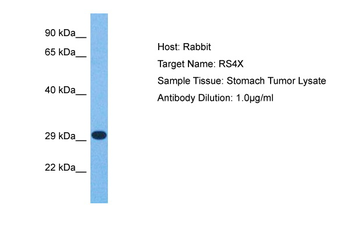 RPS4X Rabbit Polyclonal Antibody