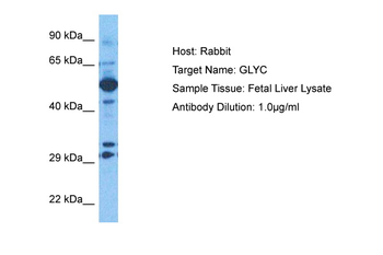 SHMT1 Rabbit Polyclonal Antibody