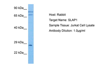 SLA Rabbit Polyclonal Antibody
