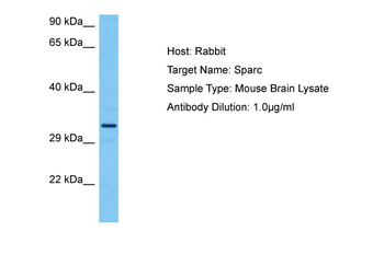 SPARC Rabbit Polyclonal Antibody